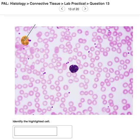 Solved Pal Histology Connective Tissue Lab Practical Chegg Com