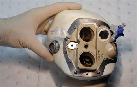 French Company Implants Its First Artificial Heart In Human