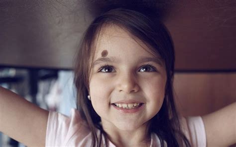 This Is The Revealed Mystery Of Birthmarks Birthmark Hair