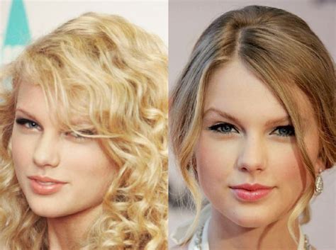 Taylor Swift Before And After Plastic Surgery 03 Celebrity Plastic