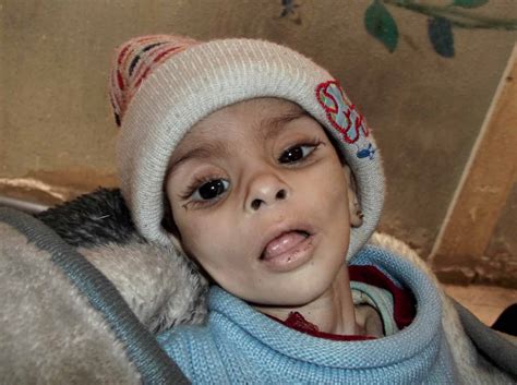 Isra Al Masri La Niña Que Murió De Hambre En El Campamento De Yamurk