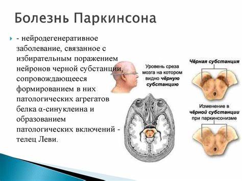 Паркинсона болезнь диета и питанием Этиология болезни Паркинсона: новые представления и новые вызовы Этиология болезни Паркинсона: новые представления и новые вызовы Паркинсона болезнь диета и питанием