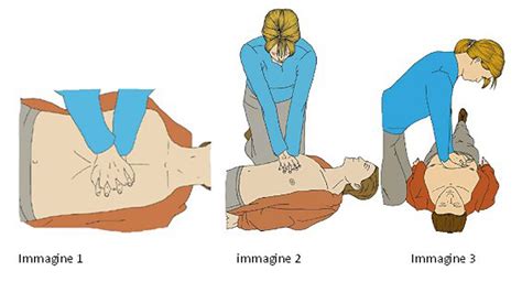 Massaggio Cardiaco Drbeckmann