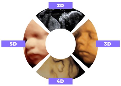 The Difference Between 2d 3d 4d Hd And 5d Ultrasound Studio