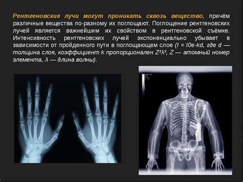 Рентгеновское излучение презентація з фізики