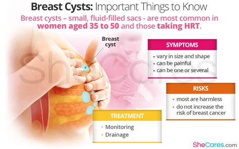 Breast Cysts Important Things To Know Shecares Hot Sex Picture
