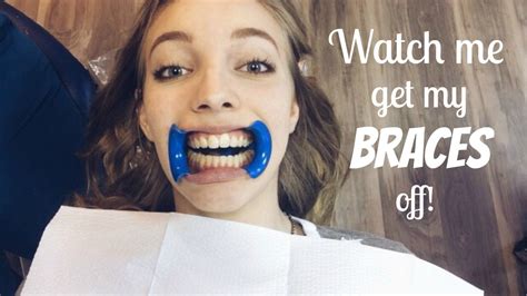 Watch Me Get My Braces Off Youtube