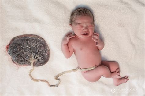 Colorado Birth Photos Baby Connected To Placenta Colorado Birth
