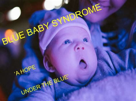 Blue Baby Syndrome A Hope Under The Blue