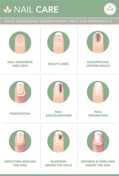 Nail Care Information — Hope And Beauty