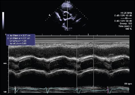 An Atlas To Explore The Current Use Of Echocardiography In Clinical