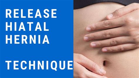 Release Hiatal Hernia And Relieve Gerd Asthma And Heart Palipatation Youtube