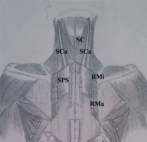 Splenius Capitis Accessories Sca Muscles Are Illustrated Sc