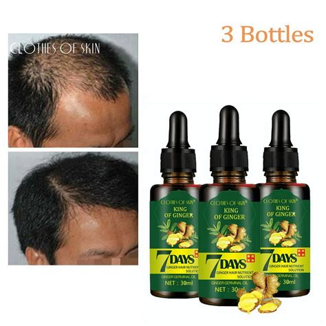 3 Pack Ginger Germinal Oil2020 Hair Growth Ginger Essential Oil Hair