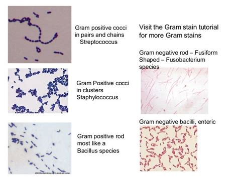 Gram Positive Cocci In Pairs And Chains Cloudshareinfo