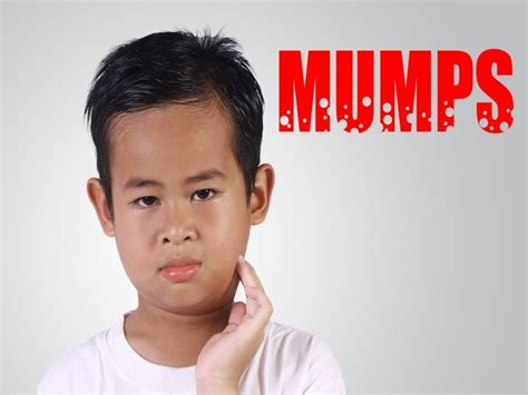 Mumps Cases Hit 10 Year High In Us