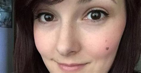 Womans Super Cute Heart Shaped Freckle Turns Out To Be Aggressive Skin Cancer Mirror Online