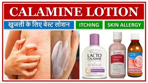 Calamine Lotion खुजली के लिए बेस्ट लोशन Itching Skin Allergy Insect