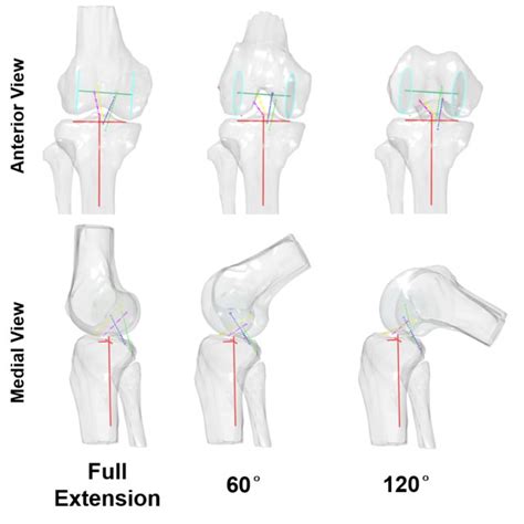 A Medial And Lateral Femoral Condyle Translation In Anterior Posterior