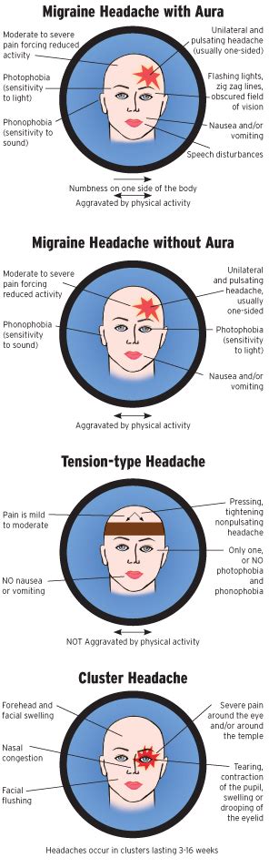 Location Different Types Of Headaches And Causes Sally Stewart