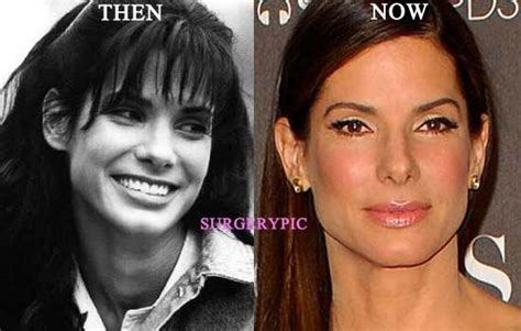 Pin On The Before And After Plastic Surgery And Environmental Influences