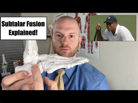 Tiger Woods Ankle Surgery Explained Tiger Woods Subtalar Joint