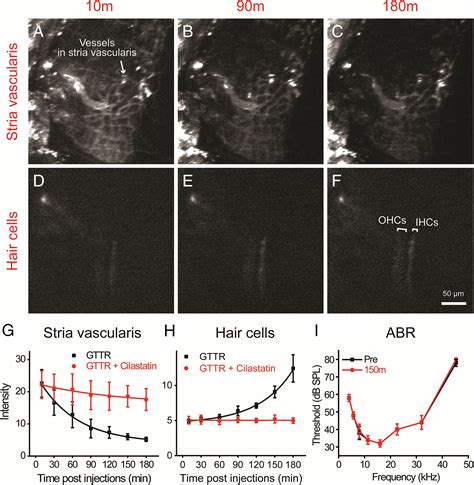 In Vivo Real Time Imaging Reveals Megalin As The Aminoglycoside