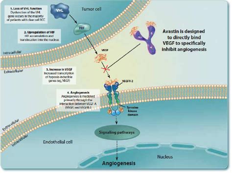 The Science Of Innovation Avastin Angiogenesis Inhibitor For Chemotherapy