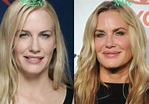 Daryl Hannah before and after plastic surgery 07 – Celebrity plastic ...