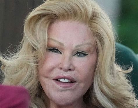 Cat Woman Plastic Surgery Before And After Why Jocelyn Wildenstein