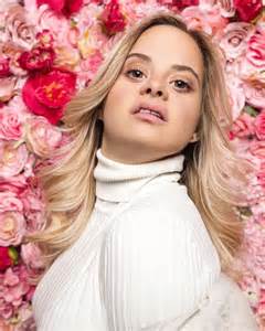 Inspirational Journey Model With Down Syndrome Takes New York Fashion