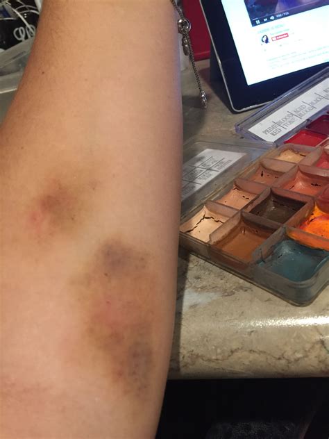 How To Make A Fake Bruise Using Halloween Makeup Gail S Blog