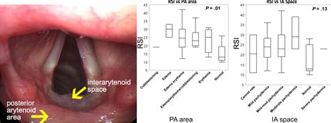 Clinical Associations In The Diagnosis Of Vocal Cord Dysfunction