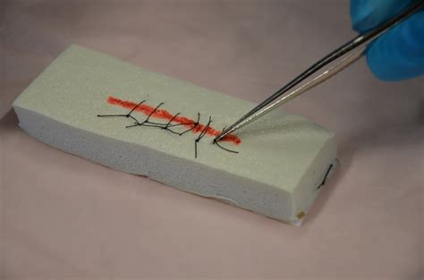 44 Suture Removal Clinical Procedures For Safer Patient Care