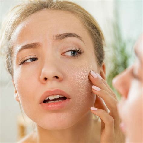 Dry Skin Type • Treatments And Skincare • Nascent Skin Clinic