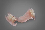 Portfólio Prótese Parcial Removível - Kion Dental