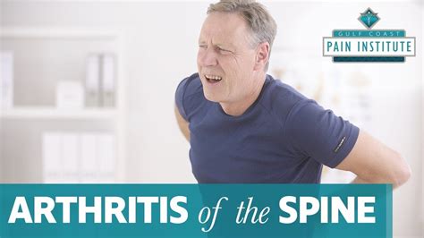 Treatment For Arthritis Of The Spine Youtube