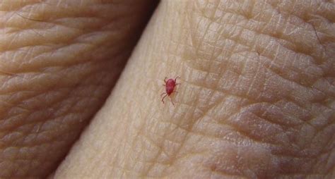 How To Get Rid Of Chiggers Eliminate Red Mites And Bugs From Your Yard