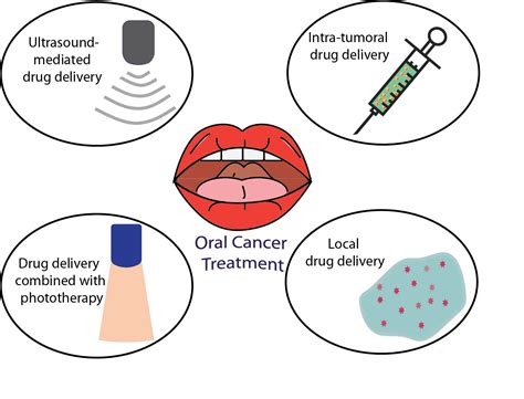 Pharmaceutics Free Full Text Controlled Drug Delivery Systems For