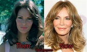 Jaclyn Smith Plastic Surgery: Before and After Facelift, Botox Pictures
