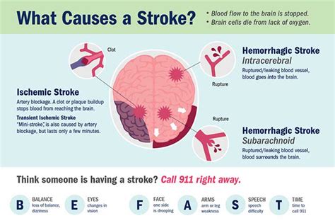 What Causes A Stroke How Totally Different Varieties Of Strokes Occur