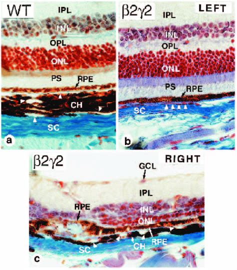 Scleral And Choroidal Defects In Rarβ2γ2 Mutant Eyes Histological
