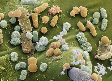 Bacteria And Fungus Seen In The Scanning And Transmission Electron Microscope Scientific
