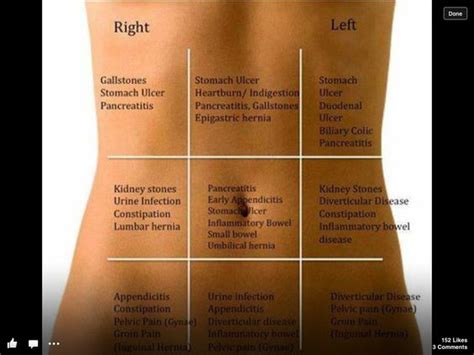 Stomach Pain Quick Guide The Common Areas Of Pain And What Areas They