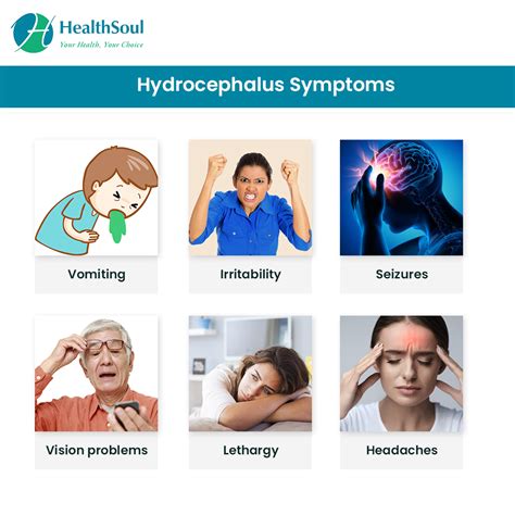 Hydrocephalus Symptoms Hydrocephalus In Adults Empiretory