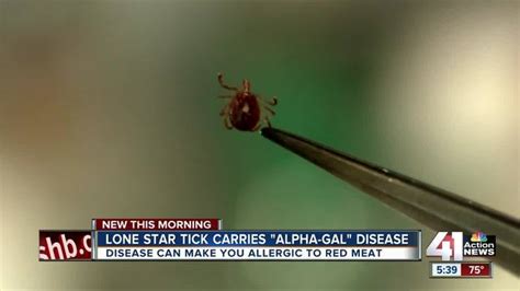 Tick Carrying Disease Can Make You Allergic To Meat 41