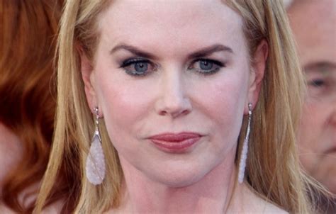 Nicole Kidman Before And After Plastic Surgery