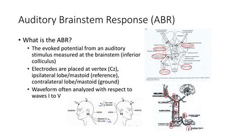 Ppt Auditory Brainstem Response Abr Powerpoint Presentation Free