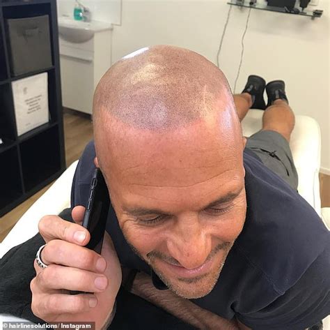 Mike Gunner Got His Hair Tattoo Just Weeks Before Filming Mafs Daily