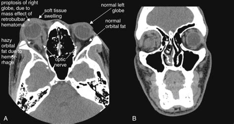 Imaging The Face Radiology Key